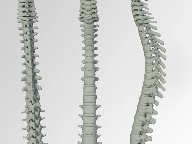 Spinal Manipulation physical therapy at Midtown East Physical Therapy in New York, NY